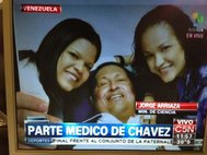 Уго Чавес после операции