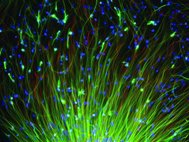 Нейронные стволовые клетки человека