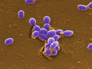 Электронная микрофотография Enterococcus faecalis